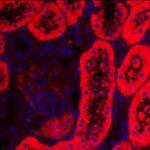 Image of an immunofluorescence micrograph