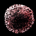 Representative fluorescence image of a tumour organoid derived from patient derived GSCs after 23 days of culture